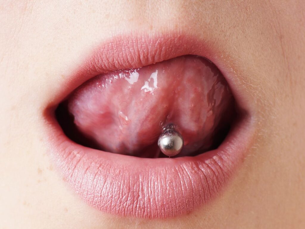 Can you have Invisalign with a tongue piercing?